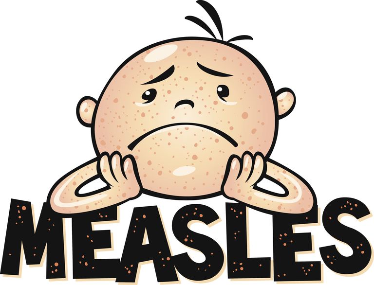 Measles Madness Blog